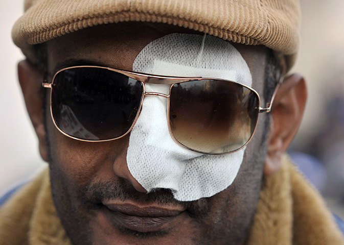Tahrir Square: An injured Egyptian attends the protest in Tahrir Square 