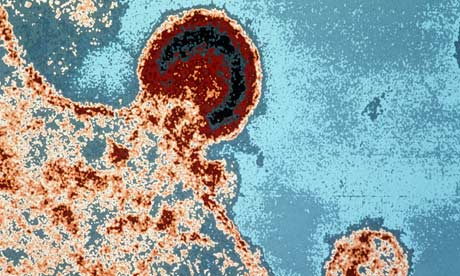 HIV 1 virus