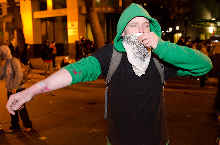 Oakland protests: protester's welt