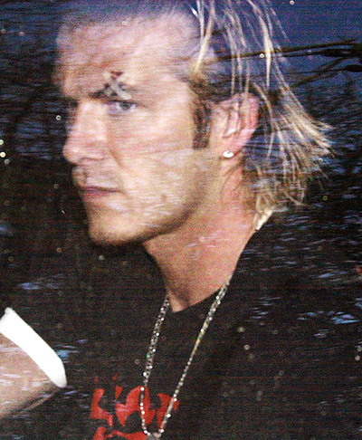 Fergie's 25 years: David Beckham leaves his home with a sticking plaster over his left eye