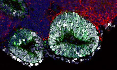 Mouse pituitary tissue grown from embryonic stem cells