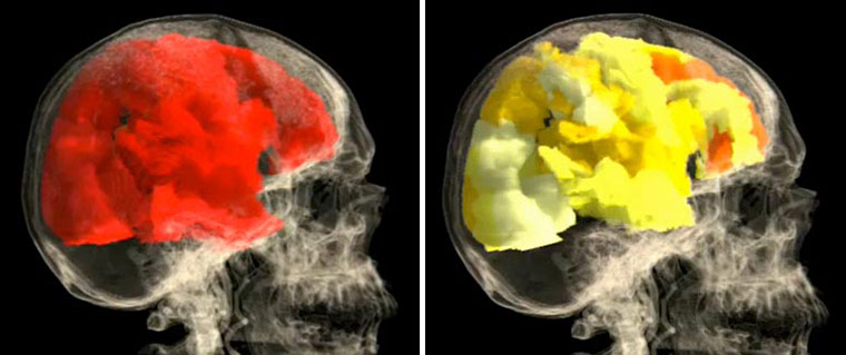  Year in Science: fMRI of woman orgasm