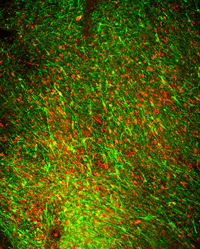 Year in science: Human dopamine nerve cells