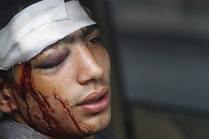 24 hours: A wounded protester rests after clashes with soldiers in Cairo, Egypt