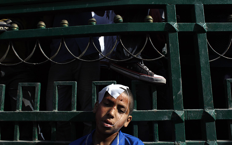 Cairo clashes: An injured Egyptian youth protester rests after getting first aid care