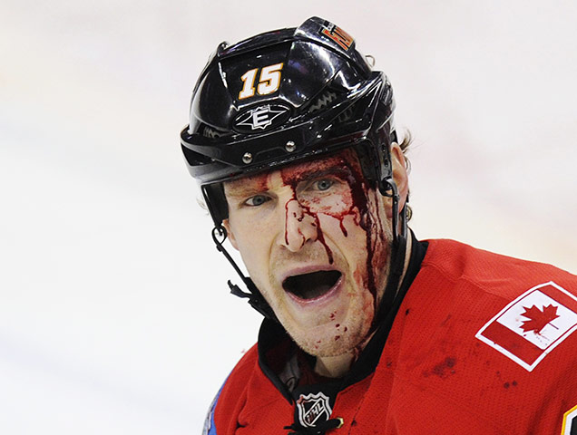 Week in Sport: A bloodied Calgary Flames' Jackman after fighting Minnesota Wild's Staubitz