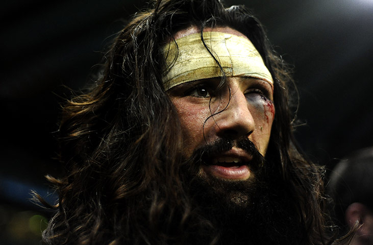 The week in sport: Oxford's Captain John Carter with a black eye