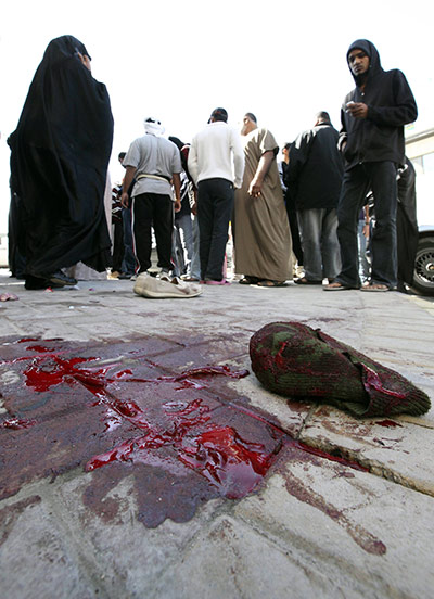 Arab unrest: Manama, Bahrain: The blood of a wounded protester