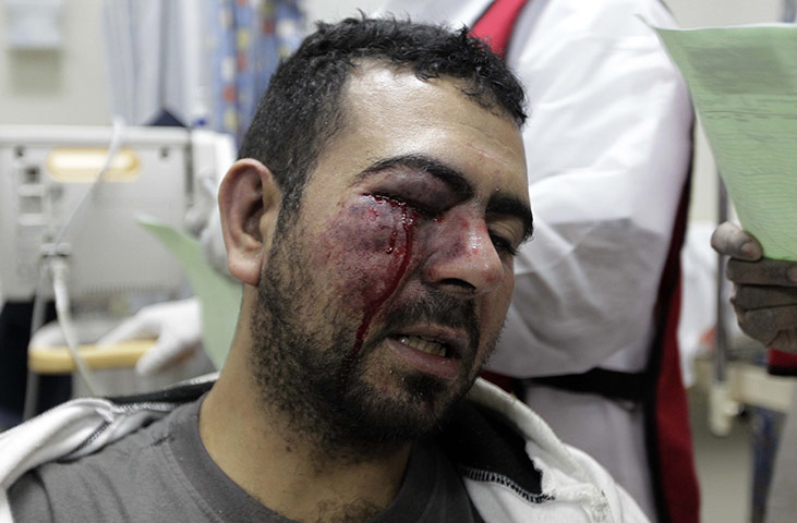 bahrain: A wounded Shiite Bahraini demonstrator 