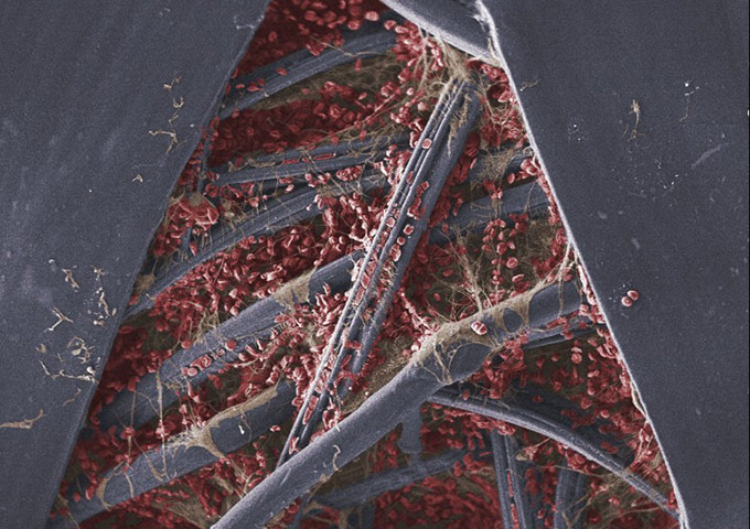 Wellcome Image Awards: Clotting blood on sticking plaster