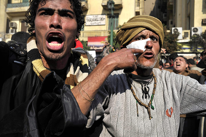 Clashes in Egypt day 9: An injured protester gestures