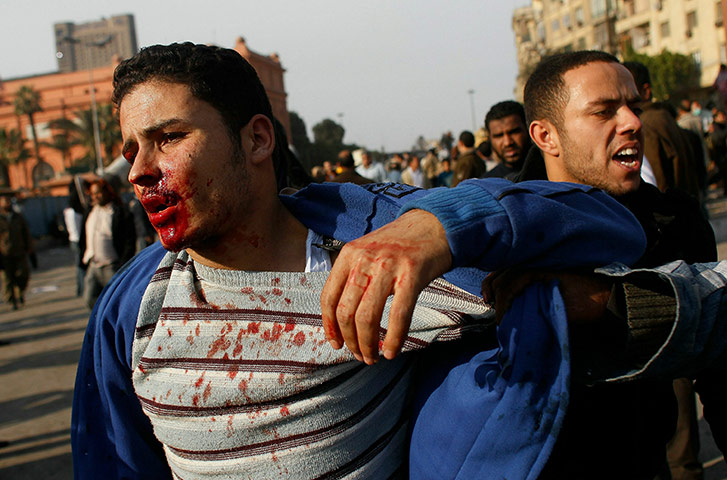 Clashes in Egypt day 9: A wounded Egyptian man is brought away from front lines during a clash