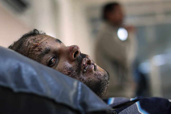 libya update 2: Halifa Awad Tajuri was injured by tank fire during violence in Benghazi 