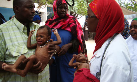 A doctor helps malnourished babies awaiting treatment at the Hawa Abdi hospital in Afgoye, Somalia