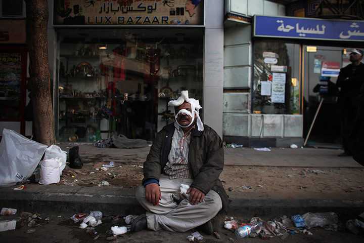 24 hours in pictures:  An injured anti-government protester sits on the ground, Egypt