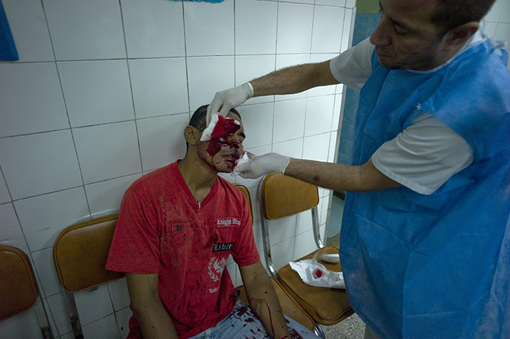 Venezuela Caracas : A man recieves treatment for a severe knife wound in Petare Caracas