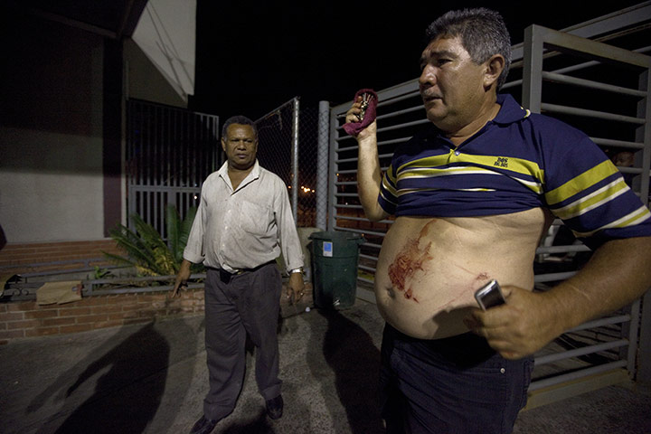 Venezuela Caracas : Caracas, Venezuela. A victim of a stabbing arrives clinic