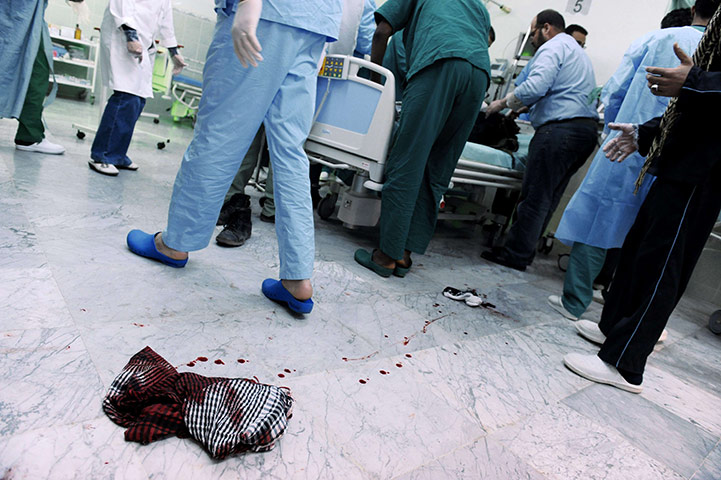 Libya, Ajdabiya: Wounded rebel fighter who was wounded during clashes at Ajdabiya