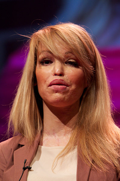 TEDx: Katie Piper at the Observer TEDx event