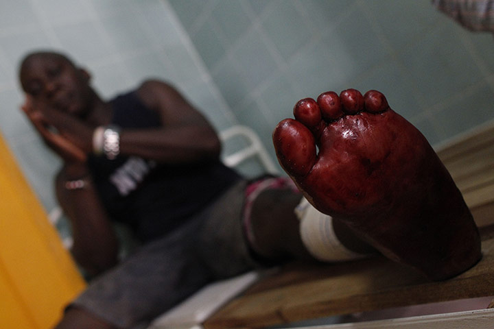Ivory Coast violence: A man shot in the leg when security forces loyal to Gbagbo opened fire