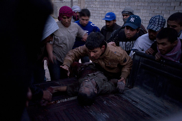 misrata: An injured pro-Gaddafi soldier is detained 