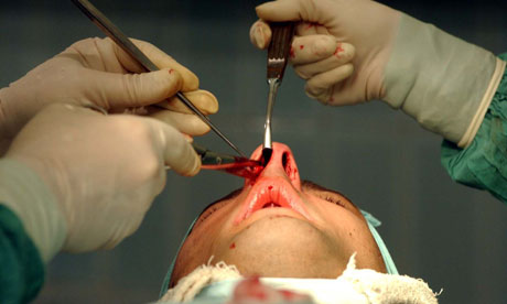 Nose surgery
