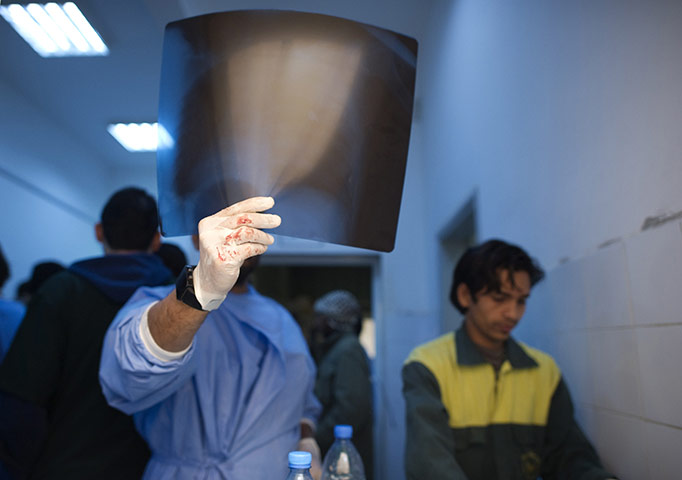 24 hours in pictures:  A doctor inspects the X-ray of a wounded Libyan rebel fighter