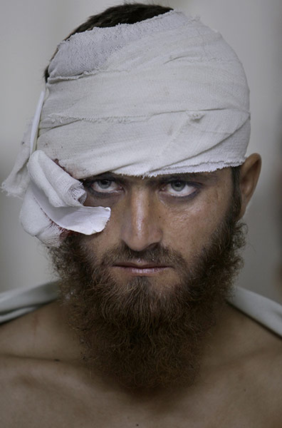 24 Hours: A man injured in twin suicide bombs attacks rests at a hospital in Pakistan