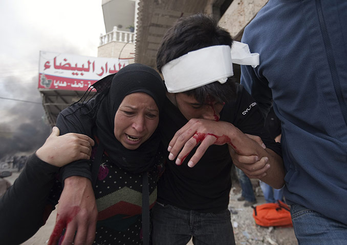 Israel violence: A wounded Palestinian during clashes near Qalandiya checkpoint