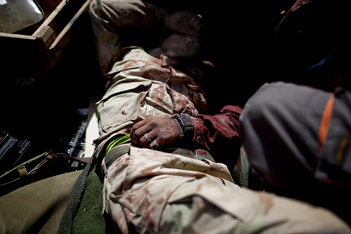 24 hours in pictures: A wounded Libyan government soldier
