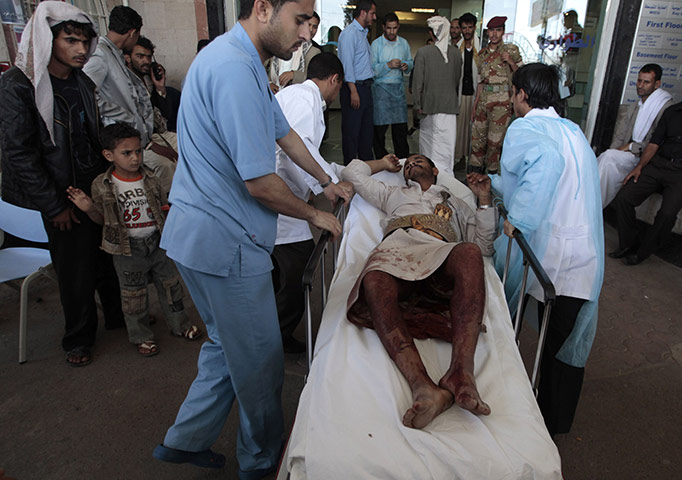 Yemen: A tribesman injured arrives at hospital