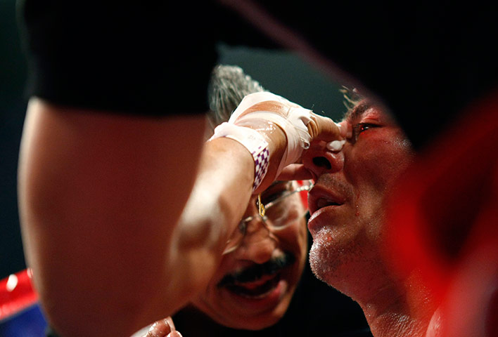 24 hours in pictures: Jorge Arce is treated at WBO championship at the MGM Grand in Las Vegas