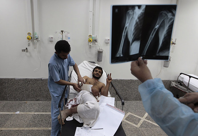 Yemen fighting: A wounded man is treated at a hospital after clashes in Sana'a 