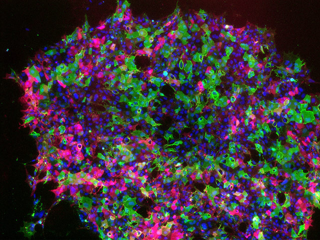 british heart foundation: Dr Evie Maifoshie