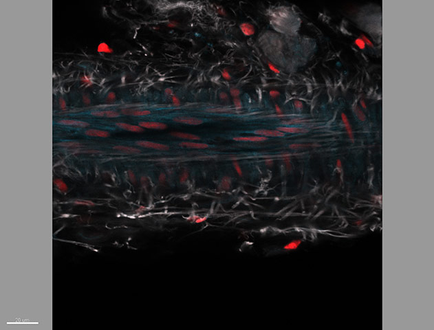 british heart foundation: Timea Belezai, University of Oxford 