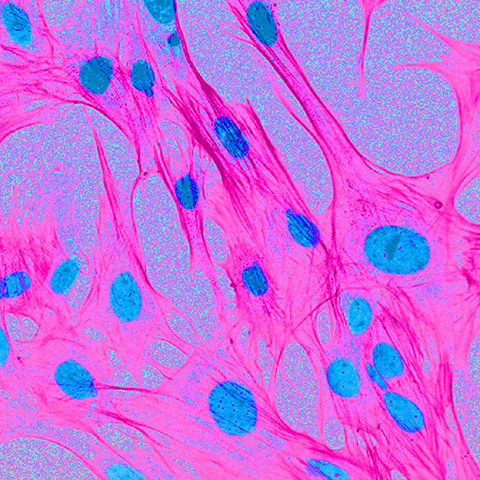 british heart foundation: Dr Patrizia Camelliti, Imperial College London 