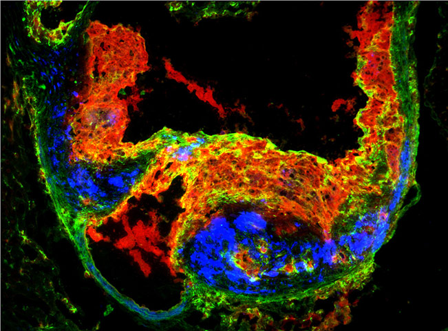 british heart foundation:  David Greaves (University of Oxford) and Professor Ed Fisher (NYU