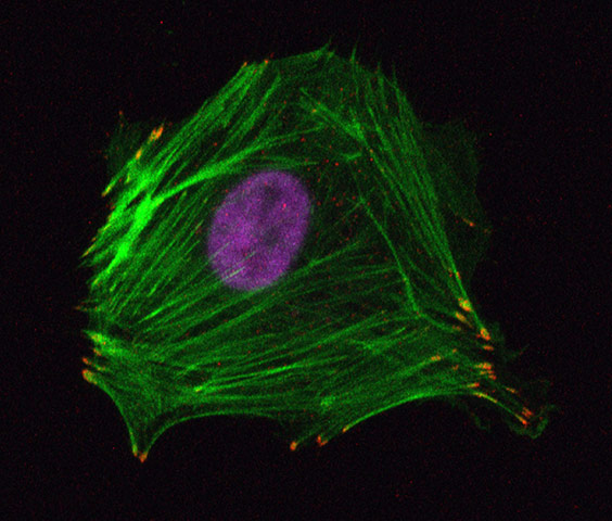 british heart foundation: Dr Richard Starke and Dr Anna Randi, Imperial College London