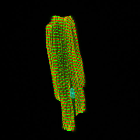 british heart foundation: Dr Thomas Cahill, University of Oxford