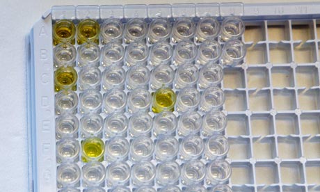 EHEC bacteria is examined in Germany