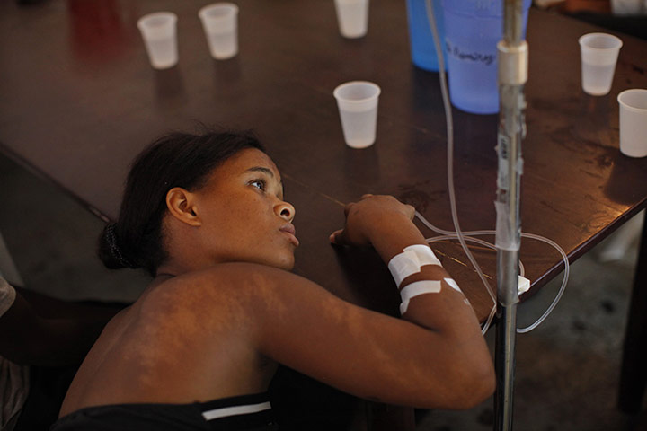 24 Hours: Santo Domingo, Dominican Republic: A patient suffering from cholera