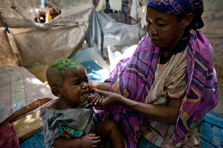 Somalia camps: for internally diplaced people due to drought and civil war