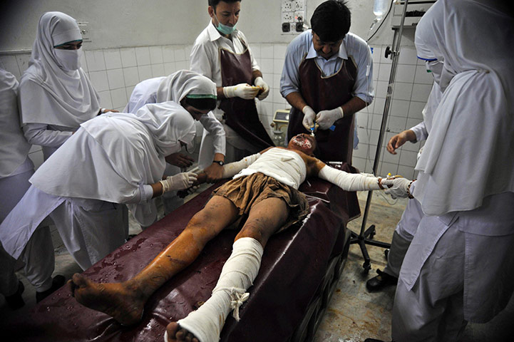 24 hours in pictures: Paramedics treat an injured bomb blast victim at a hospital in Peshawar