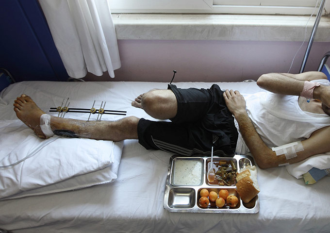 Syrian Refugees: A tray of food lies next to a wounded Syrian man