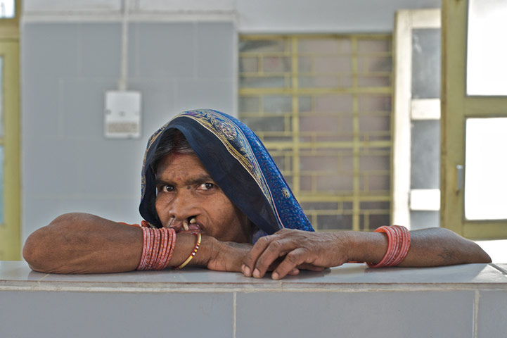 Lifeline Express Hospital: visit to Umaria in Central Madhya Pradesh, India