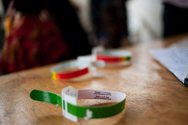 24 hours: Dadaab, Kenya: Medium upper arm circumference measuring bands 