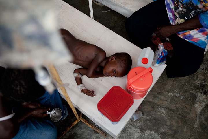 24 hours in pictures: A four-year-old child receives treatment for cholera symptoms in Haiti
