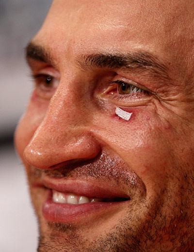 Haye v Klitschko: Wladimir Klitschko at the post-fight press conference
