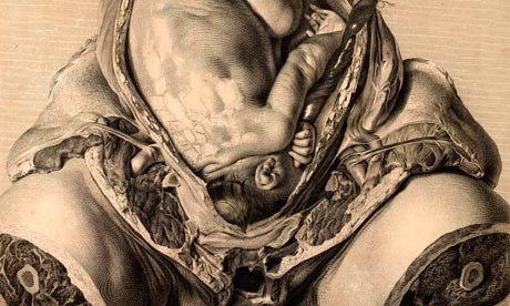 William Hunter's 1774 Anatomy of the Human Gravid Uterus