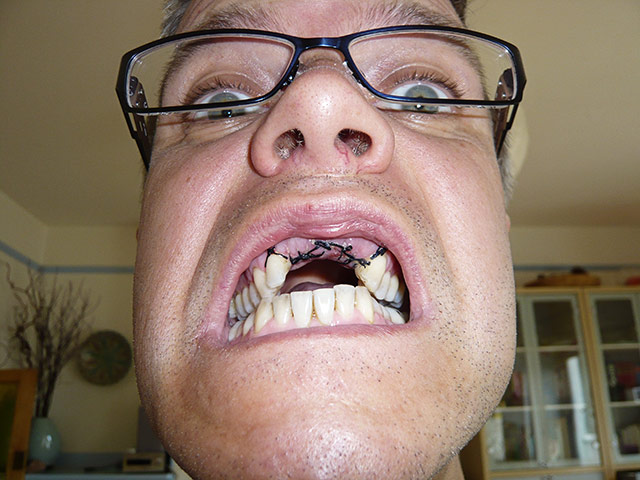 In pictures: Gap: gap in teeth